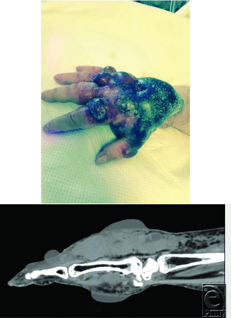 graphic file with name eplasty15ic44_fig1.jpg