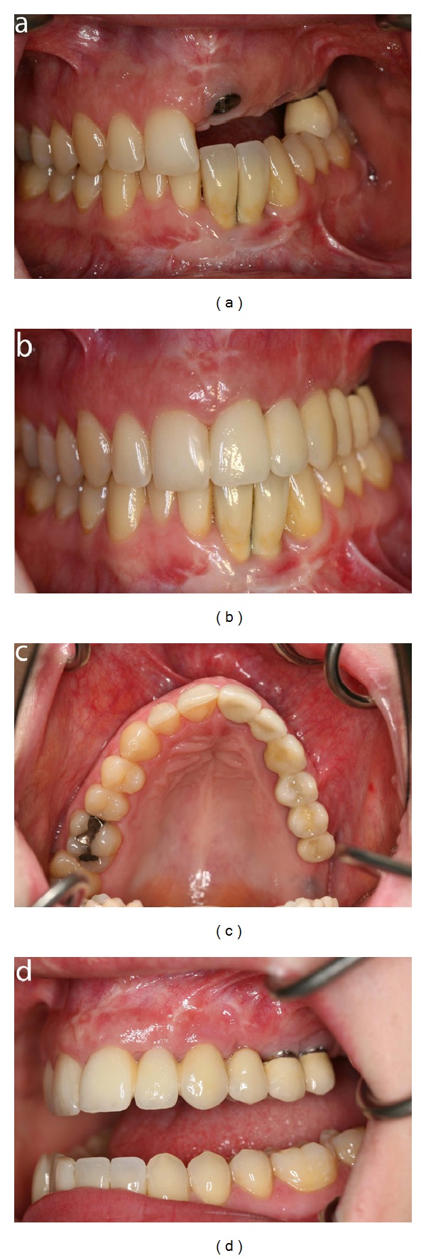 Figure 12