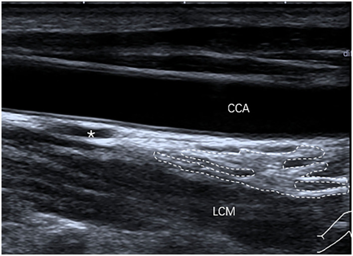 Figure 6