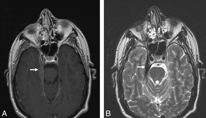 Fig 1.