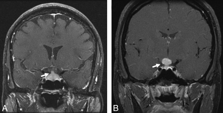 Fig 7.