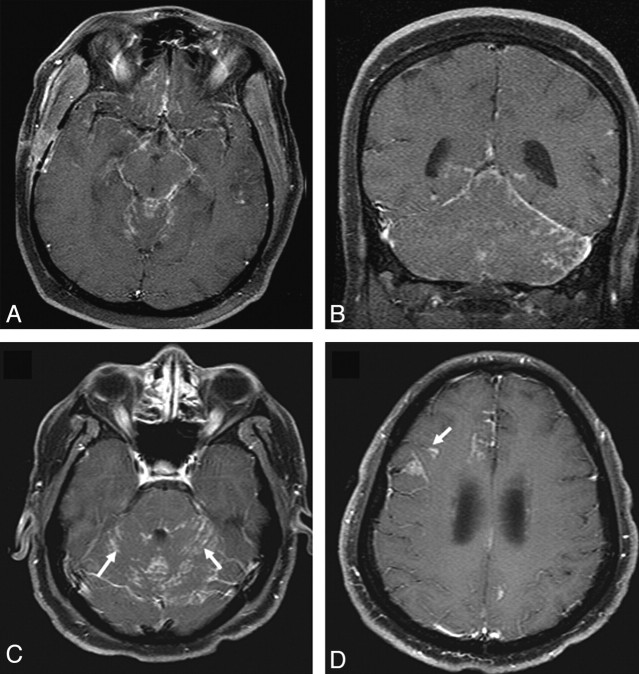 Fig 3.