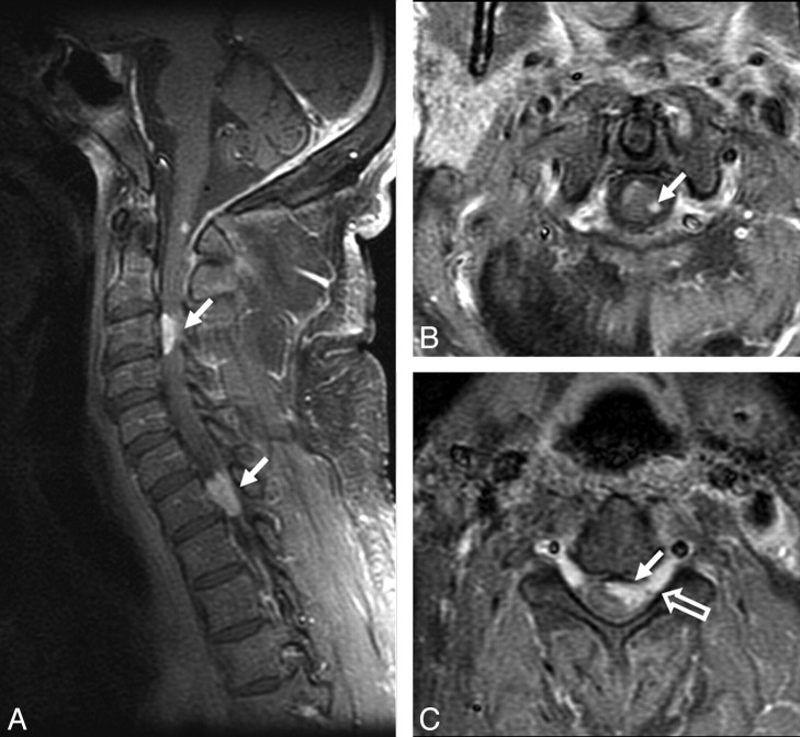 Fig 6.