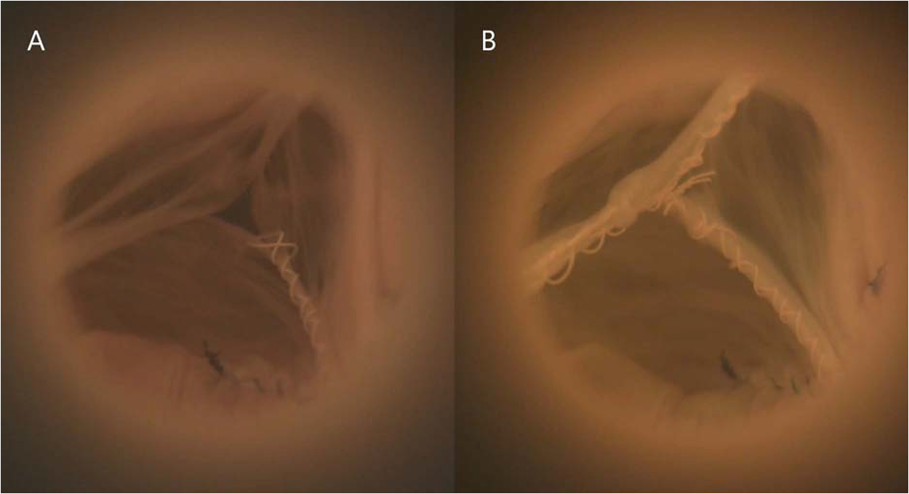 Figure 5: