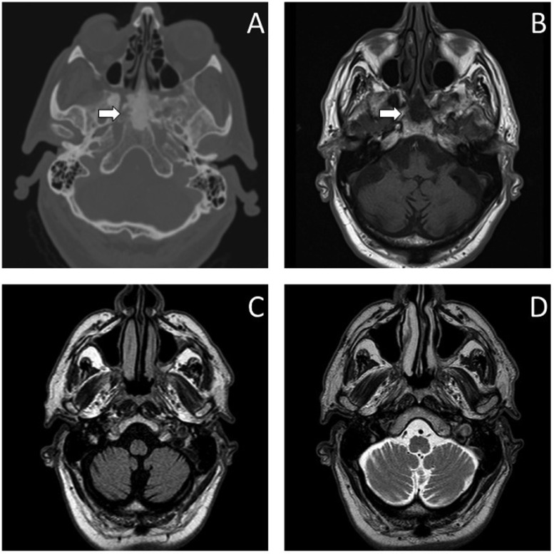 Fig 10