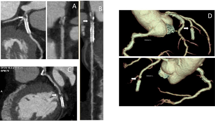 Fig 5