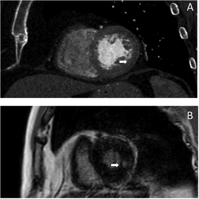 Fig 6