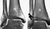 Fig. 1A–B