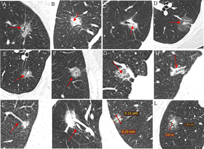 Figure 2