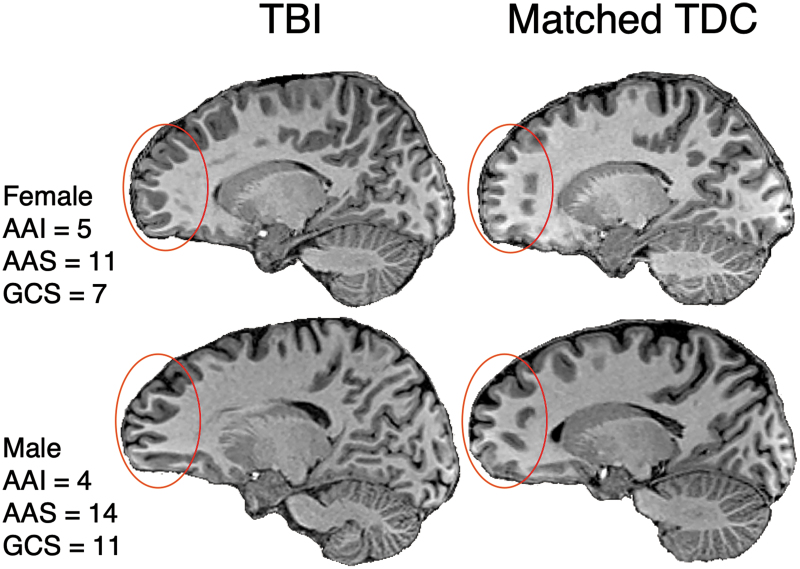 FIG. 2.