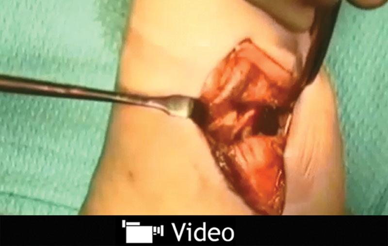 Video Graphic 3.