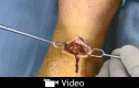 Video Graphic 2.