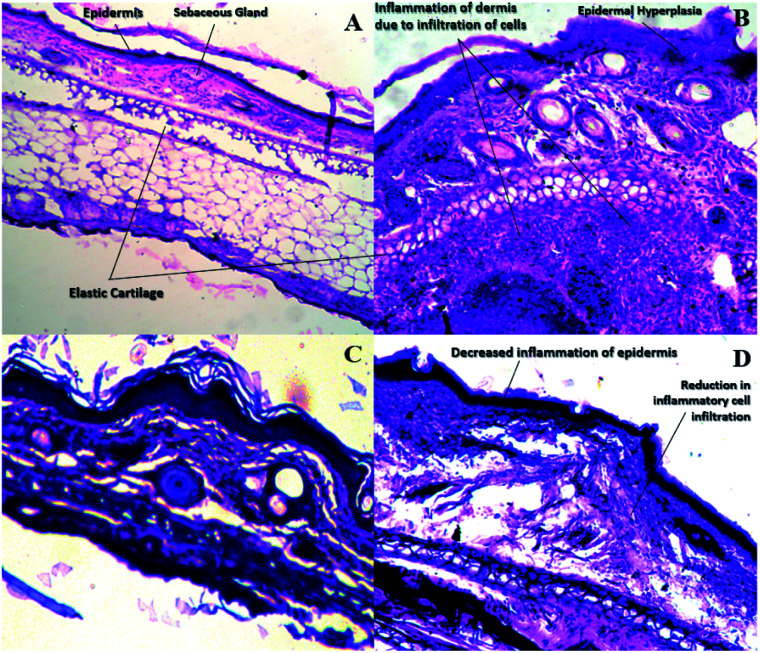 Fig. 14