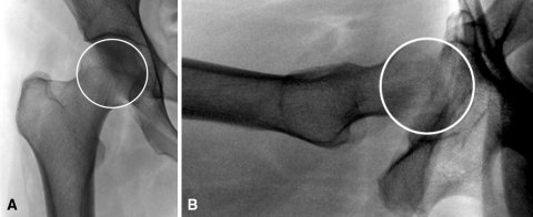 Fig. 1A–B