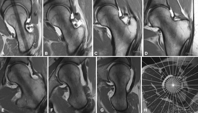 Fig. 6A–H