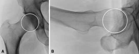 Fig. 2A–B