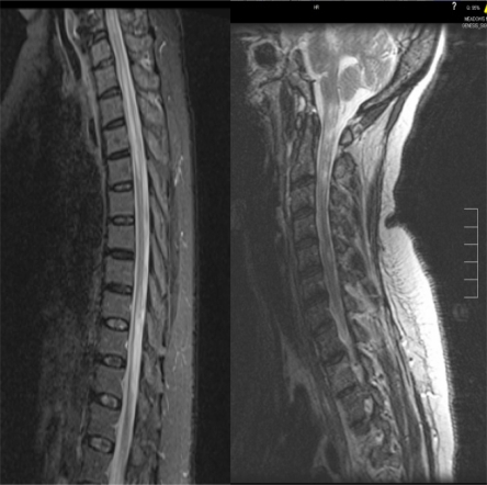 Fig. (2a, b)