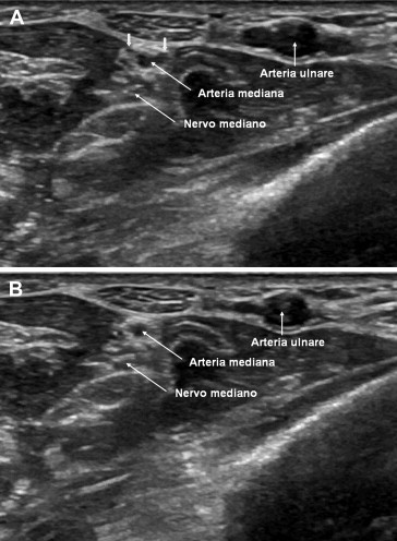 Fig. 6