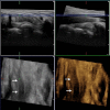 Fig. 3
