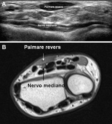 Fig. 9