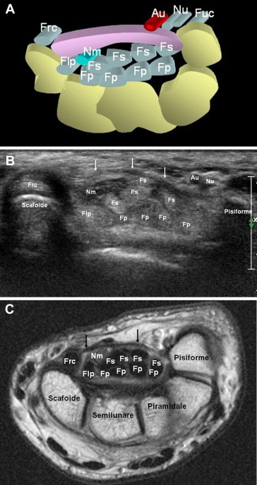 Fig. 1