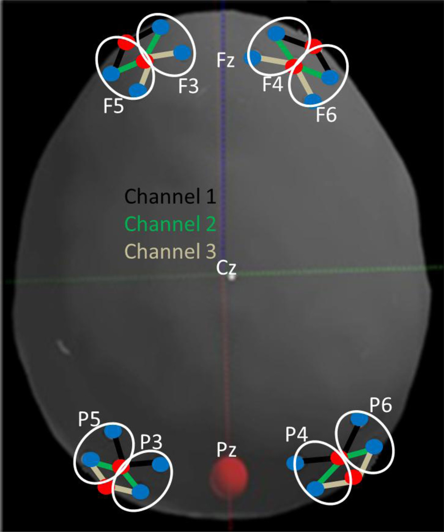 Figure 4