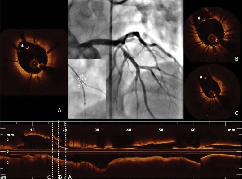 Figure 3: