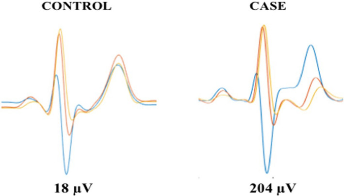 FIGURE 1