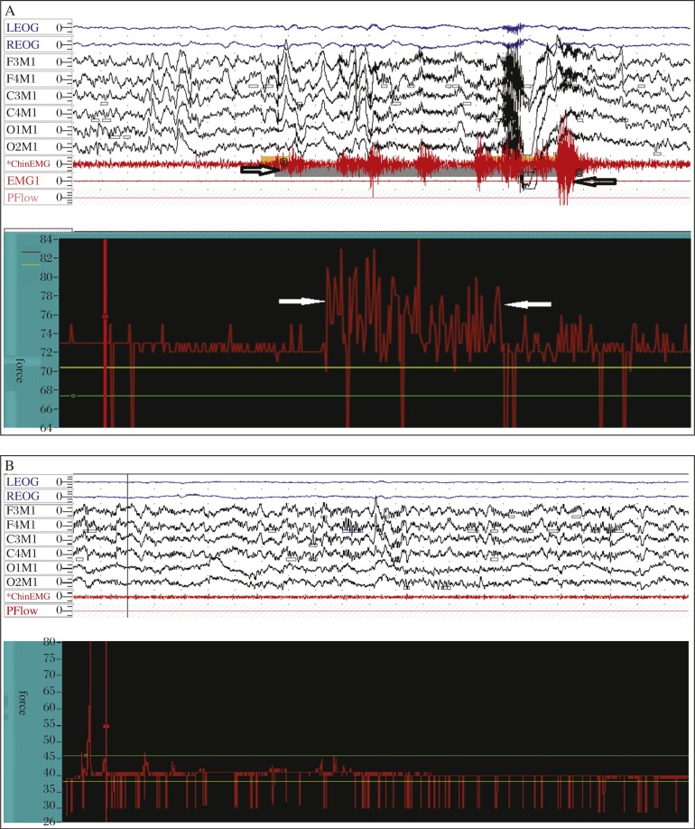 Fig. 4