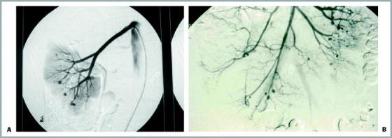 Figure 21B-1