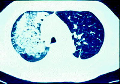 Figure 21C-3
