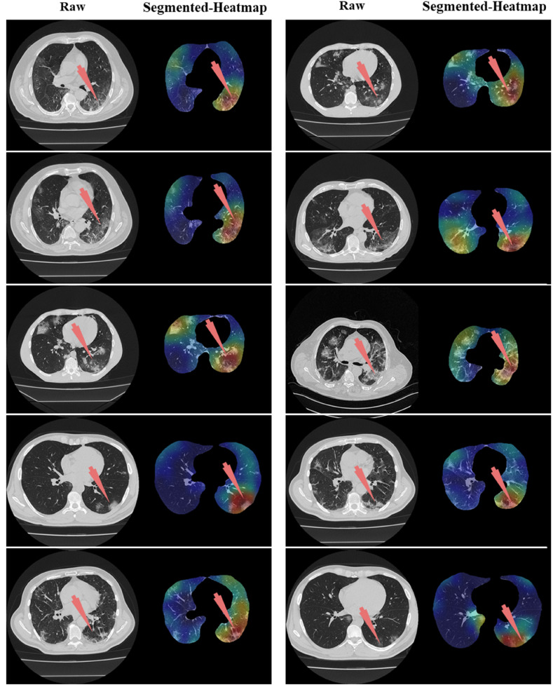 Fig. 35