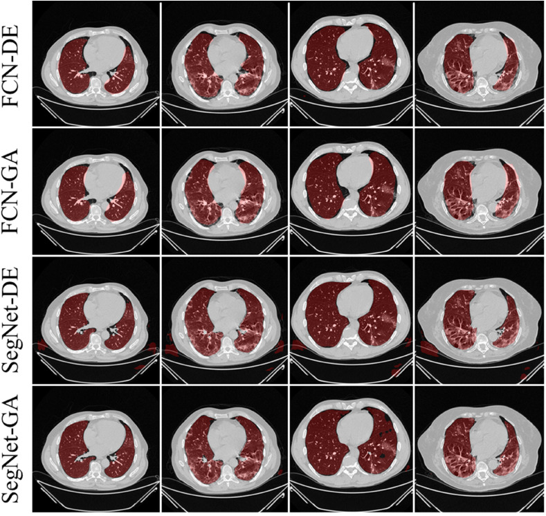 Fig. 16