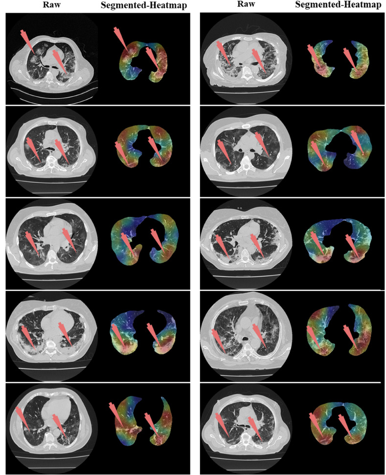 Fig. 36