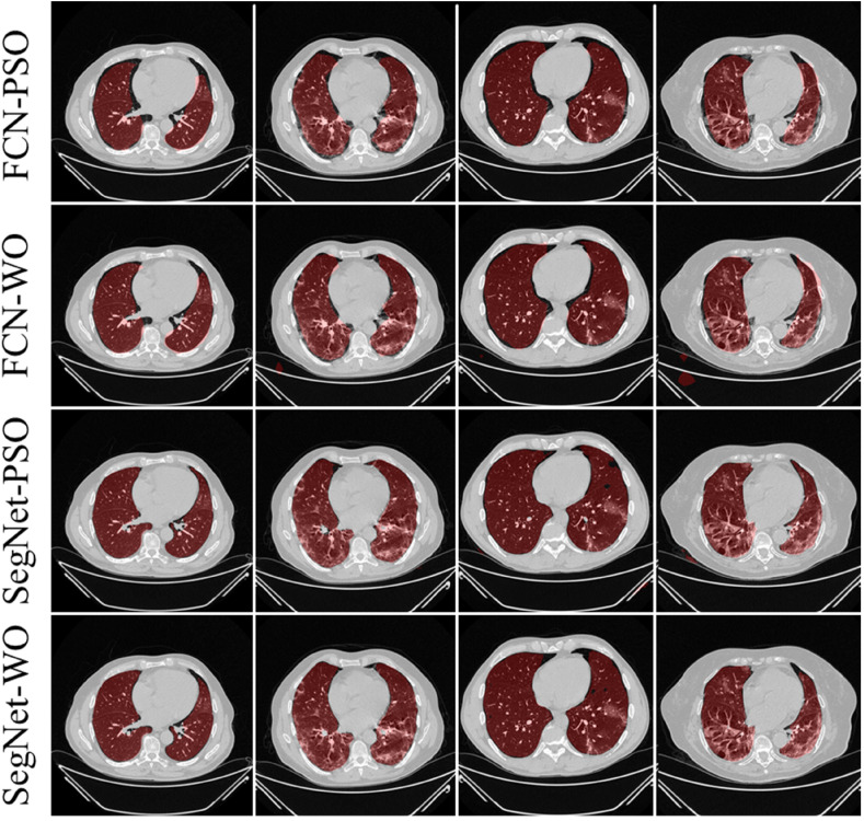 Fig. 17