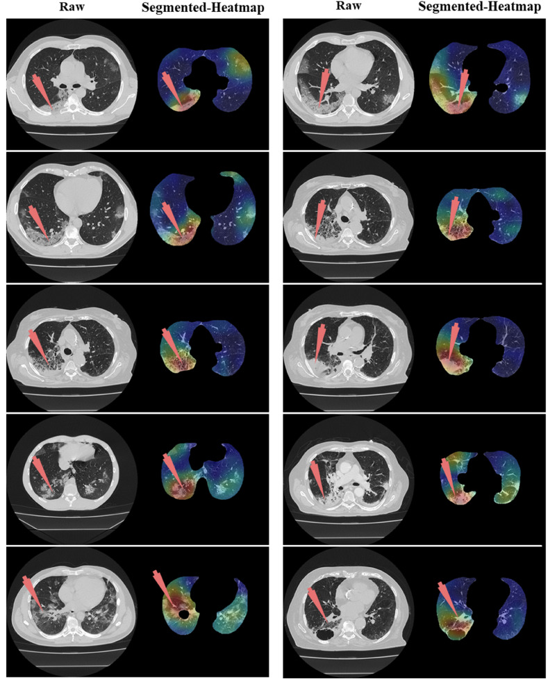 Fig. 34