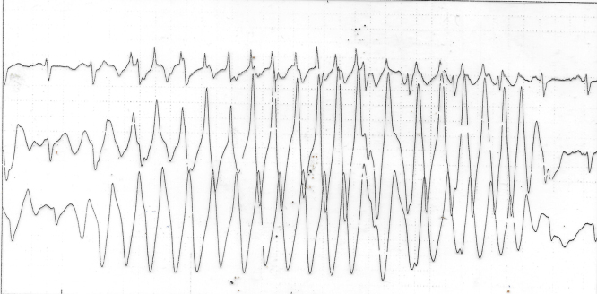 Fig. 5