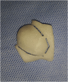 Fig. 3
