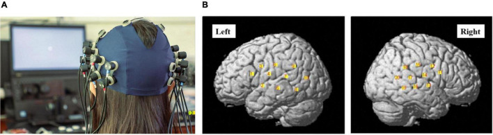 FIGURE 3