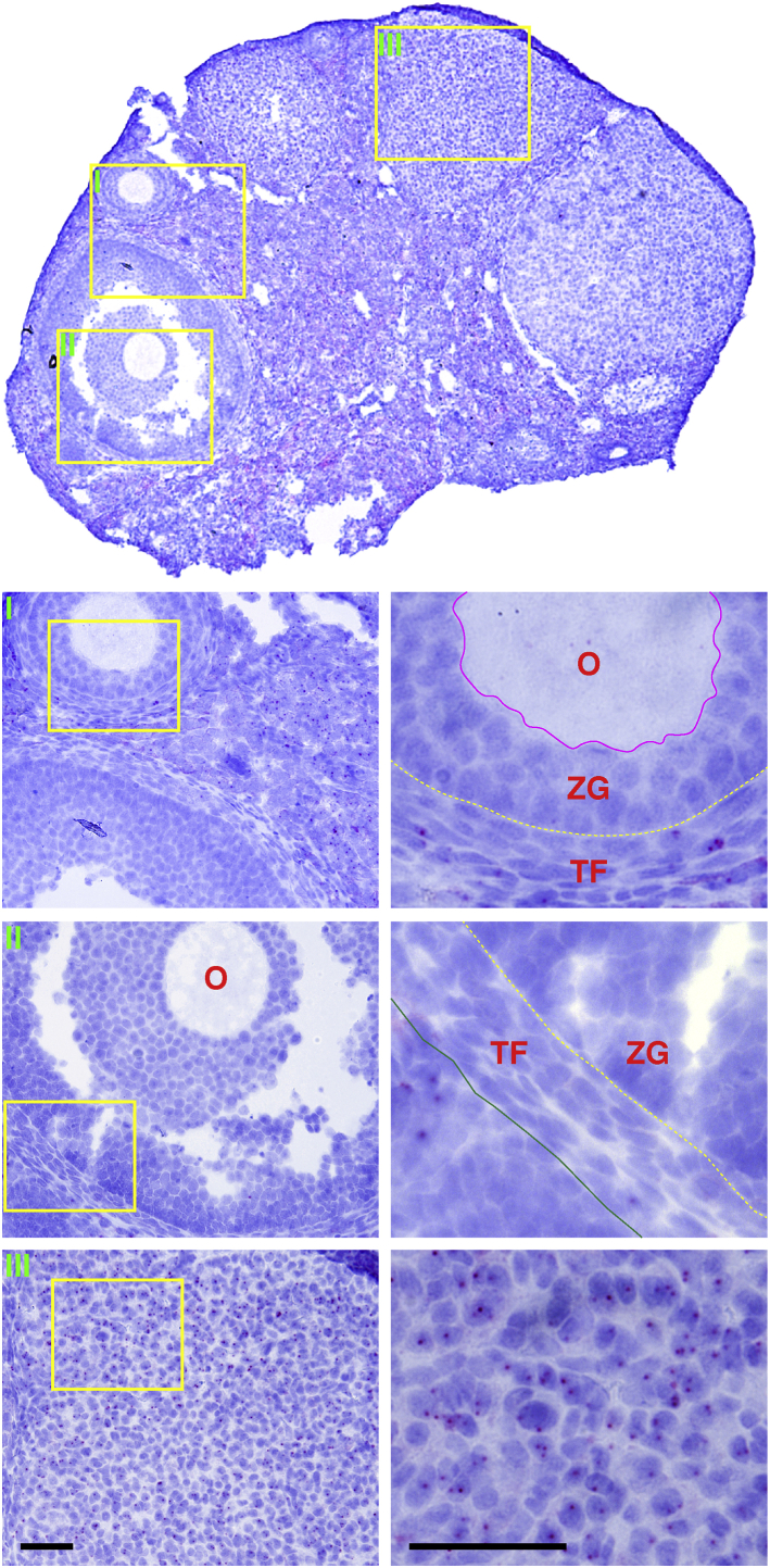 Figure 11