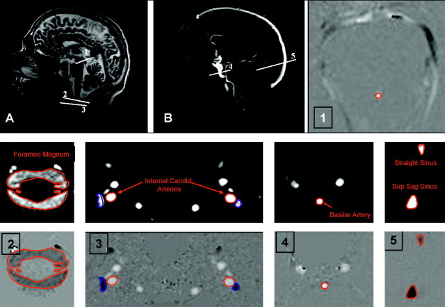 Fig 3.