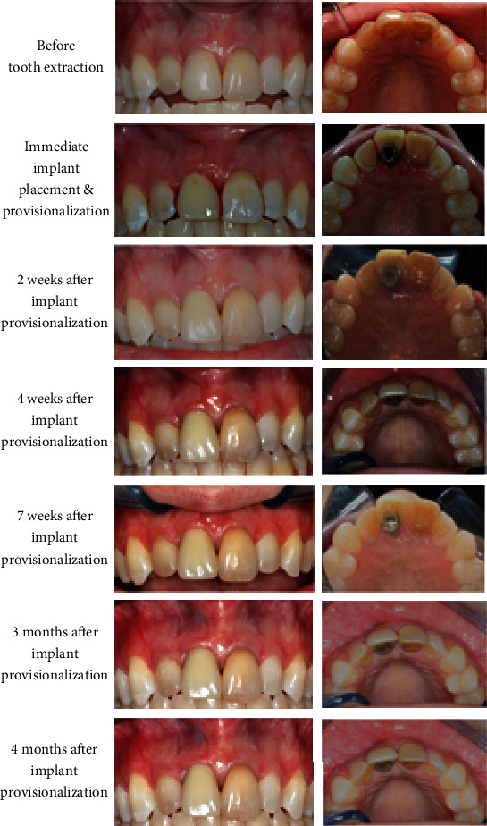 Figure 6