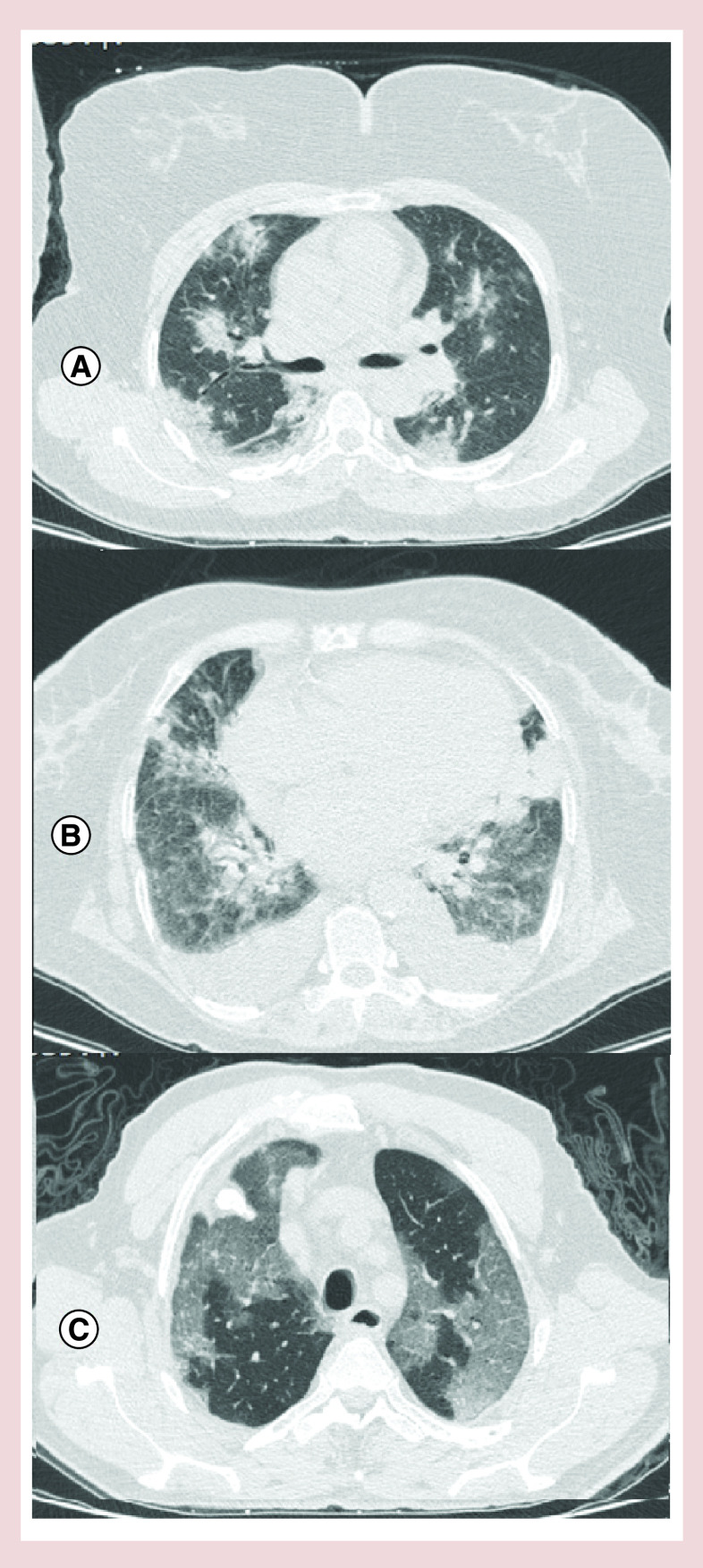 Figure 2. 