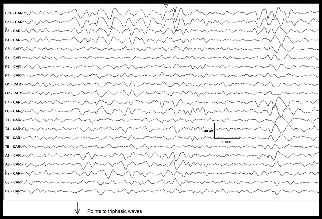 Fig 3