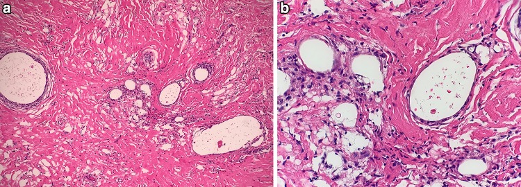 Fig. 13