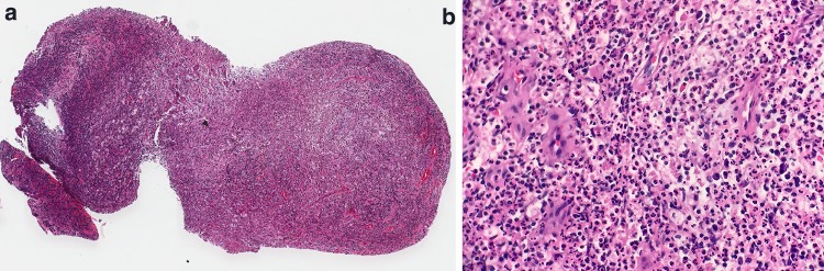 Fig. 10