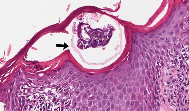 Fig. 11