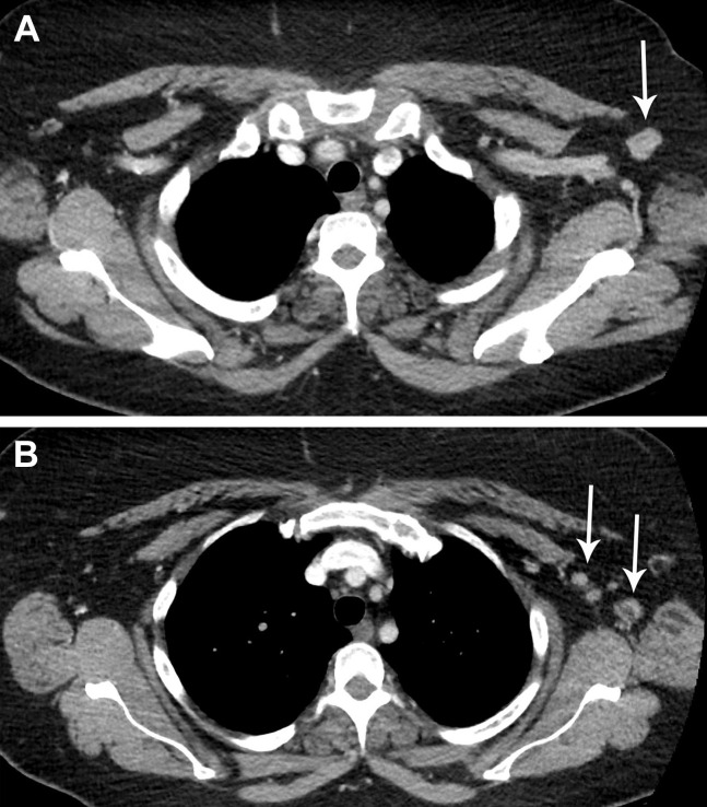 Fig 5