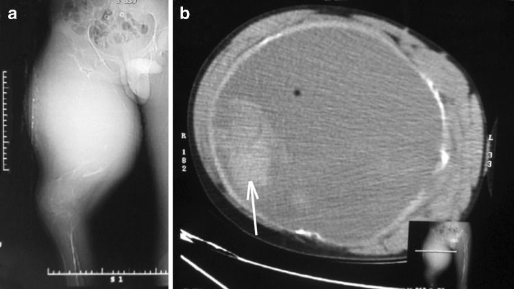 Fig. 1