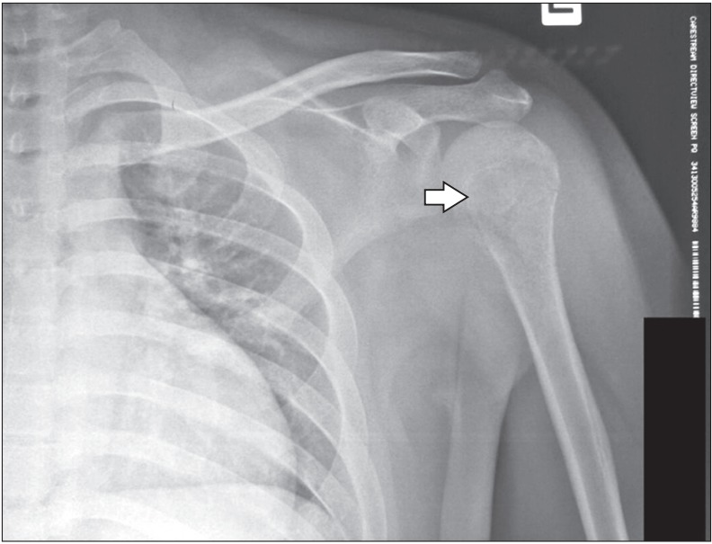 Figure. 1.